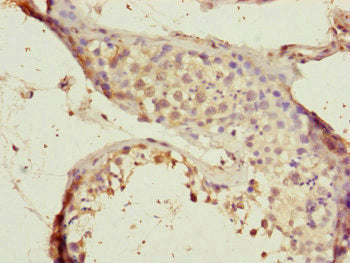 CEP72 Antibody