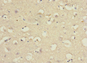 PCDH10 Antibody