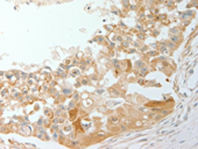 ADM Antibody