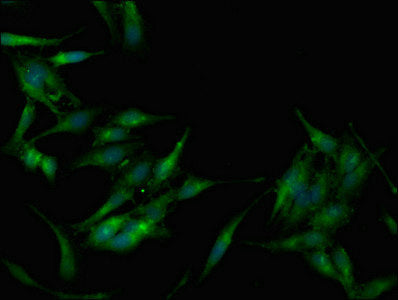 PRKAB1 Antibody