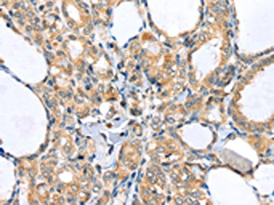 LLGL2 Antibody