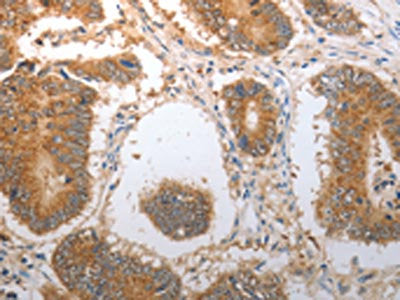NQO1 Antibody