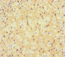 KLHL3 Antibody