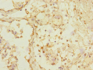 TRHDE Antibody