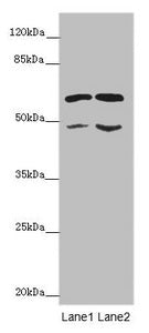 ST3GAL5 Antibody