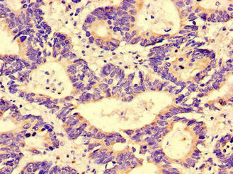 GGA1 Antibody