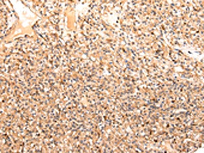 ZPR1 Antibody