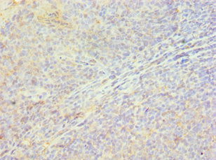 HSPB8 Antibody
