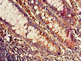 MED23 Antibody