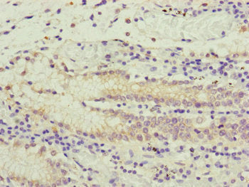 PCDHA12 Antibody