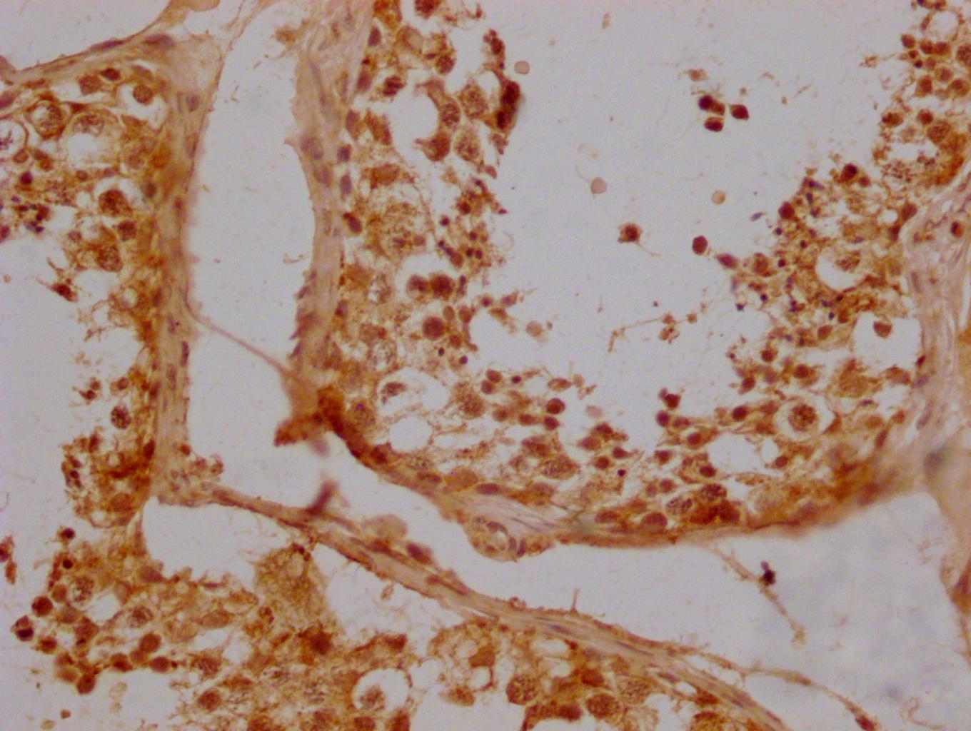 ERVW-1 Antibody