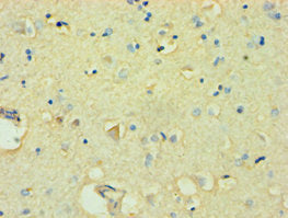 FBXW11 Antibody
