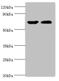 CROT Antibody