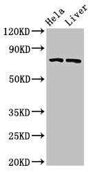 ACSL5 Antibody