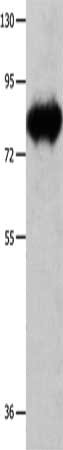 ECE1 Antibody