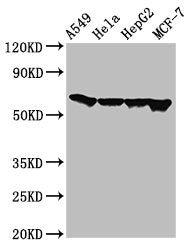 FZD10 Antibody