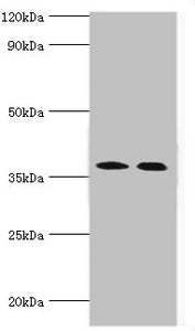 CA14 Antibody