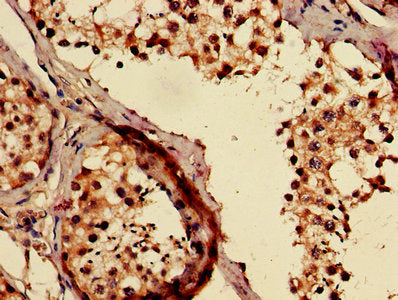 TMCO1 Antibody