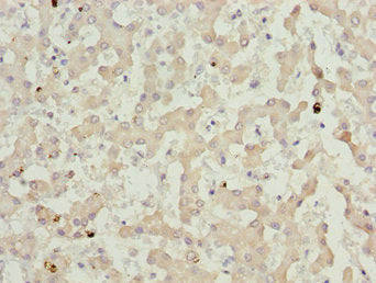 LHX6 Antibody