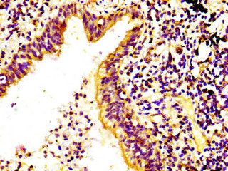 RPS6KA6 Antibody