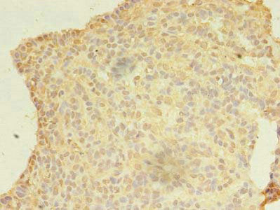KIAA1257 Antibody