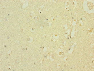 SCN8A Antibody