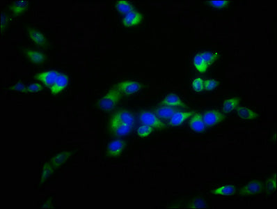 FBXL2 Antibody