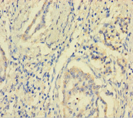 MCTS1 Antibody