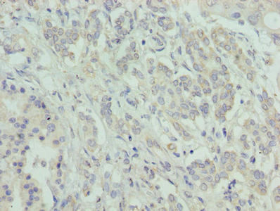 ATXN7L1 Antibody