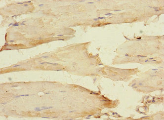 ITGB1BP2 Antibody