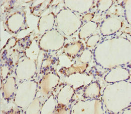 MTUS1 Antibody