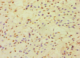 CBLC Antibody