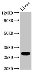 RAB26 Antibody