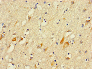 PLCL2 Antibody
