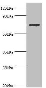 SLC25A13 Antibody