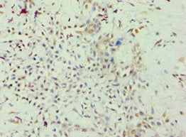 ARHGAP26 Antibody
