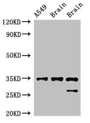 STUB1 Antibody