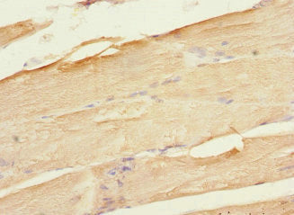 PLA2G4C Antibody