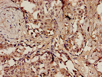 POLE Antibody