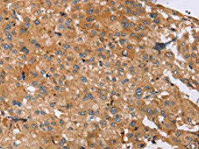 SLC39A7 Antibody