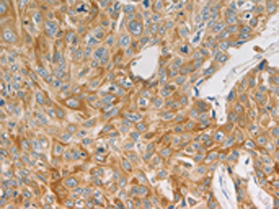 MAP2K6 Antibody