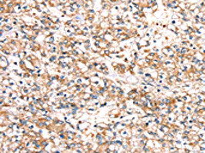 SLC24A3 Antibody