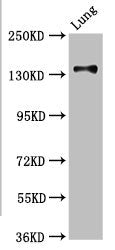 MAN2B2 Antibody