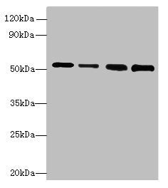 STK38L Antibody