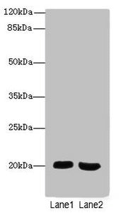 MSRB2 Antibody