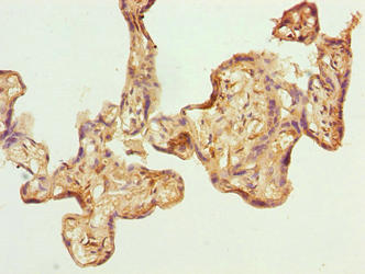GPSM3 Antibody