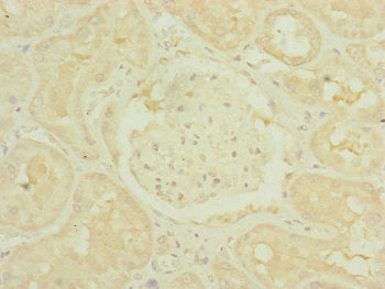 TIMM10B Antibody