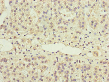 PPP2R3B Antibody