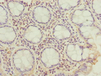 CFAP20 Antibody