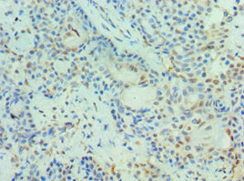 PIAS3 Antibody